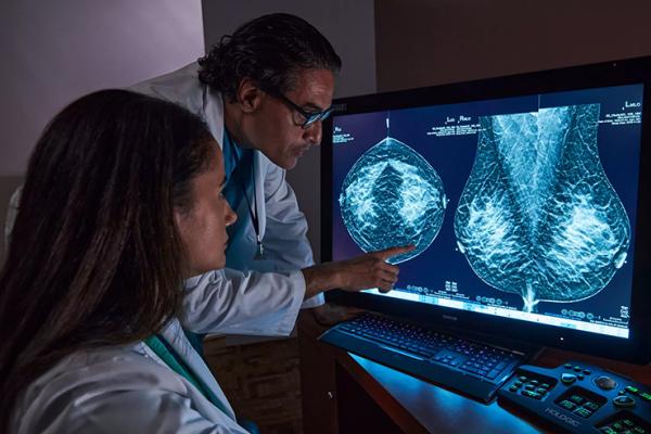 Radiographers reviewing tomosynthesis mammography on a screen