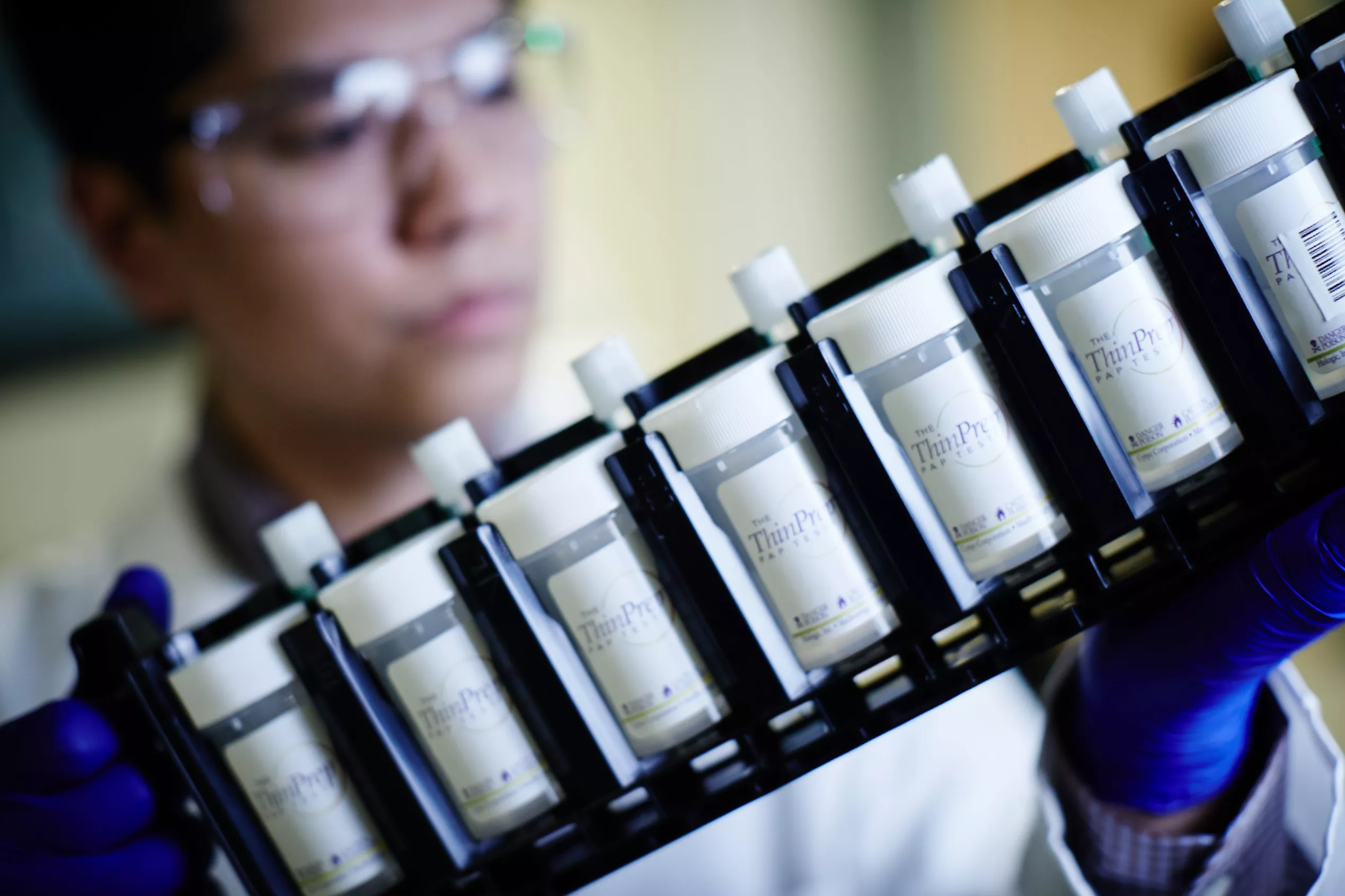 Lab technician with goggles holding onto tray of vials