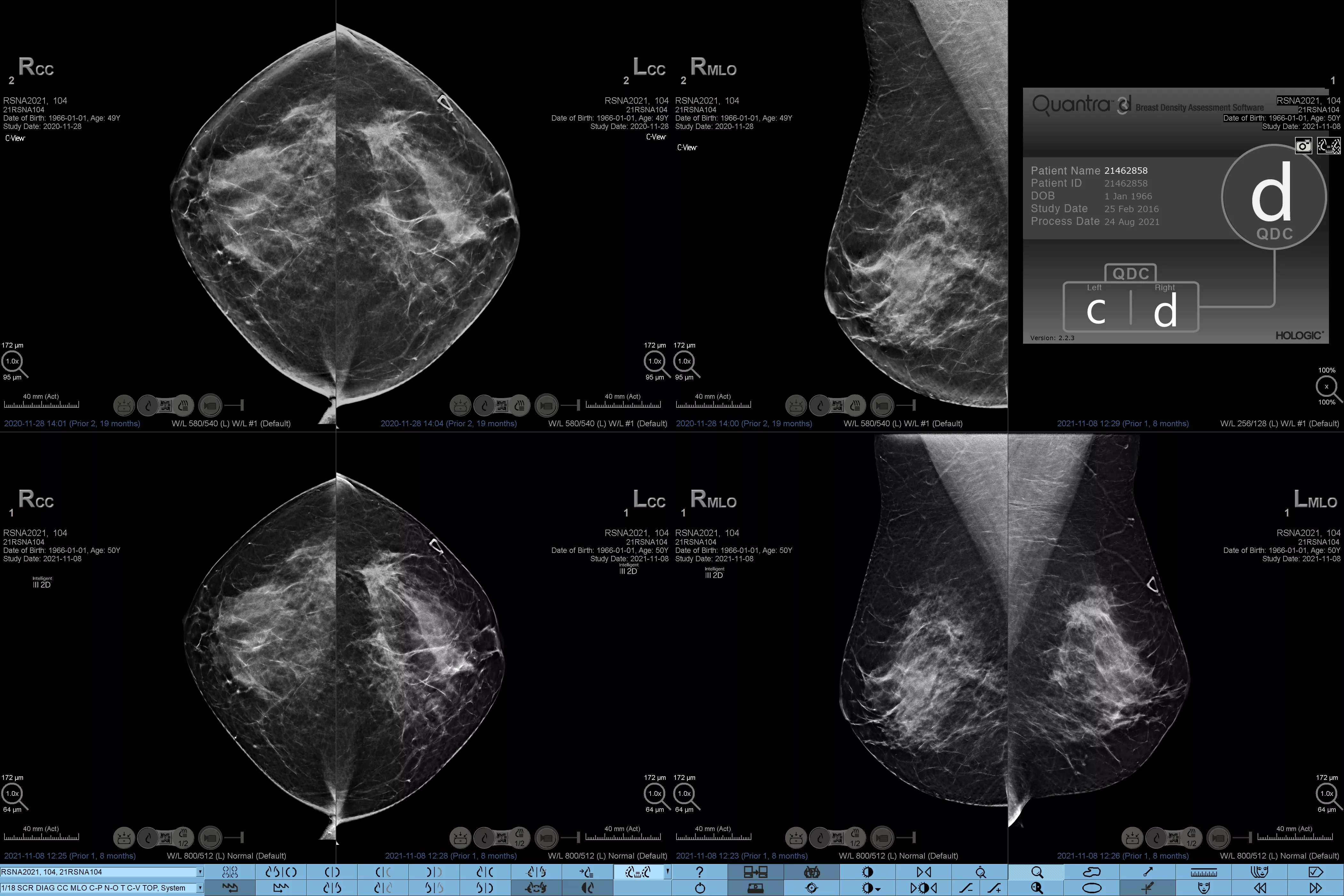 x-ray image