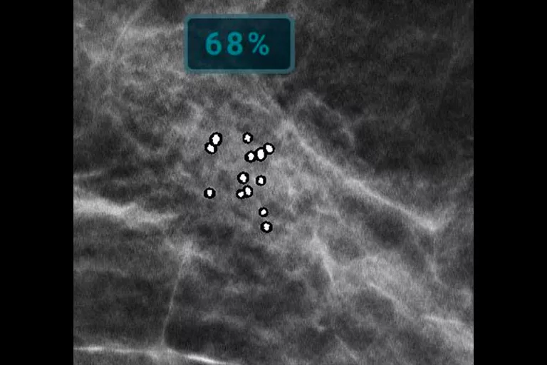 image of x-ray