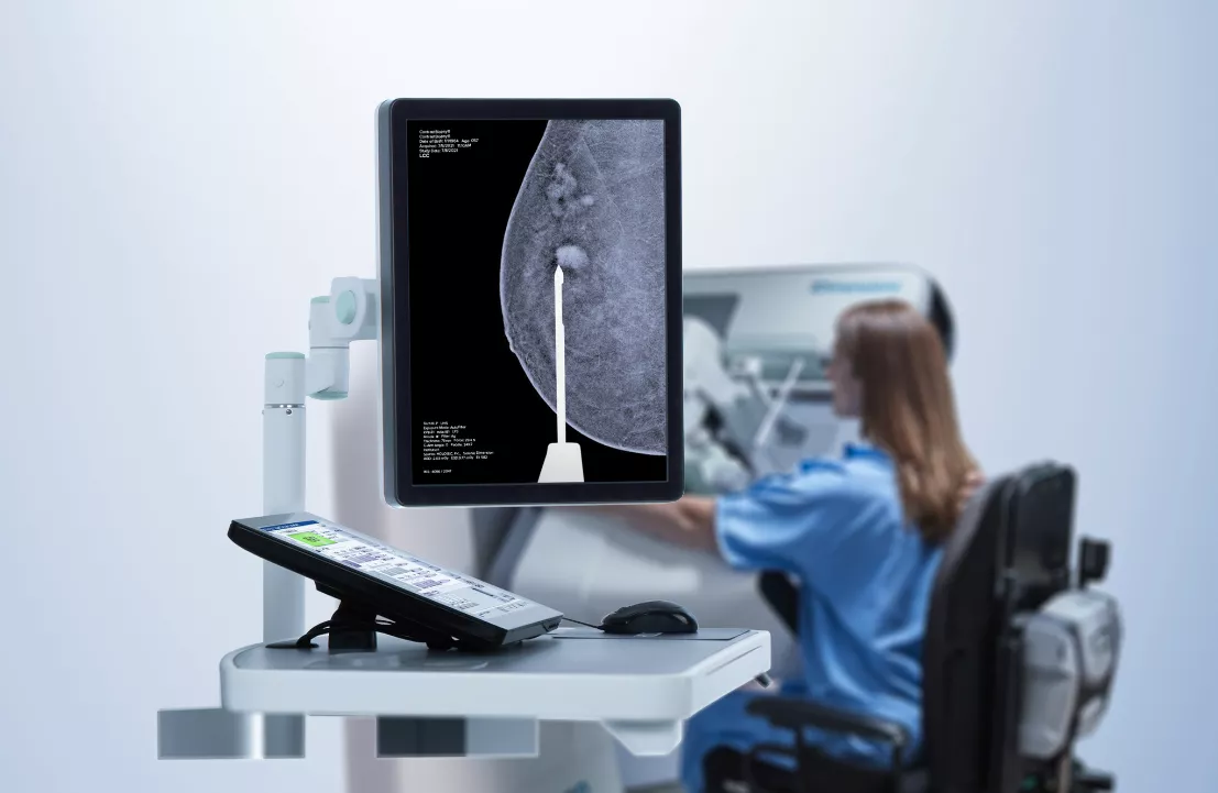 3D contrast mammography on a computer screen